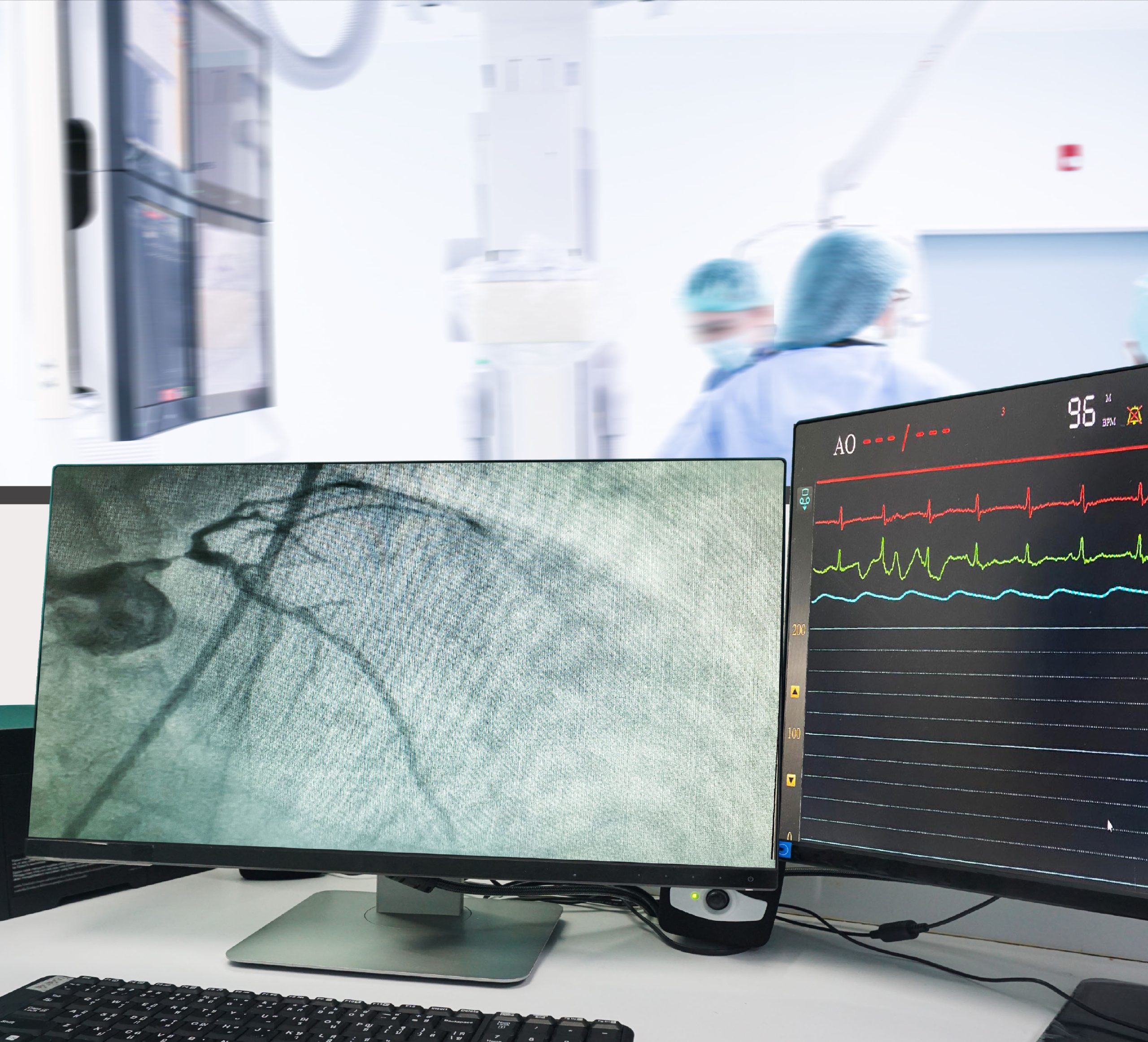 Diagnostic Angiography